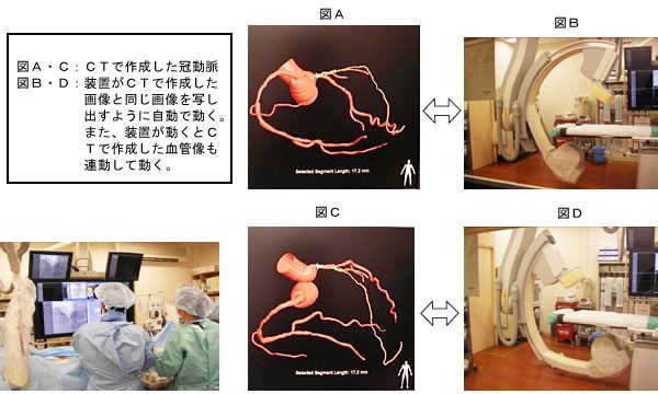 CT＋血管撮影の特徴